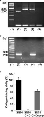 Cnm of Streptococcus mutans is important for cell surface structure and membrane permeability